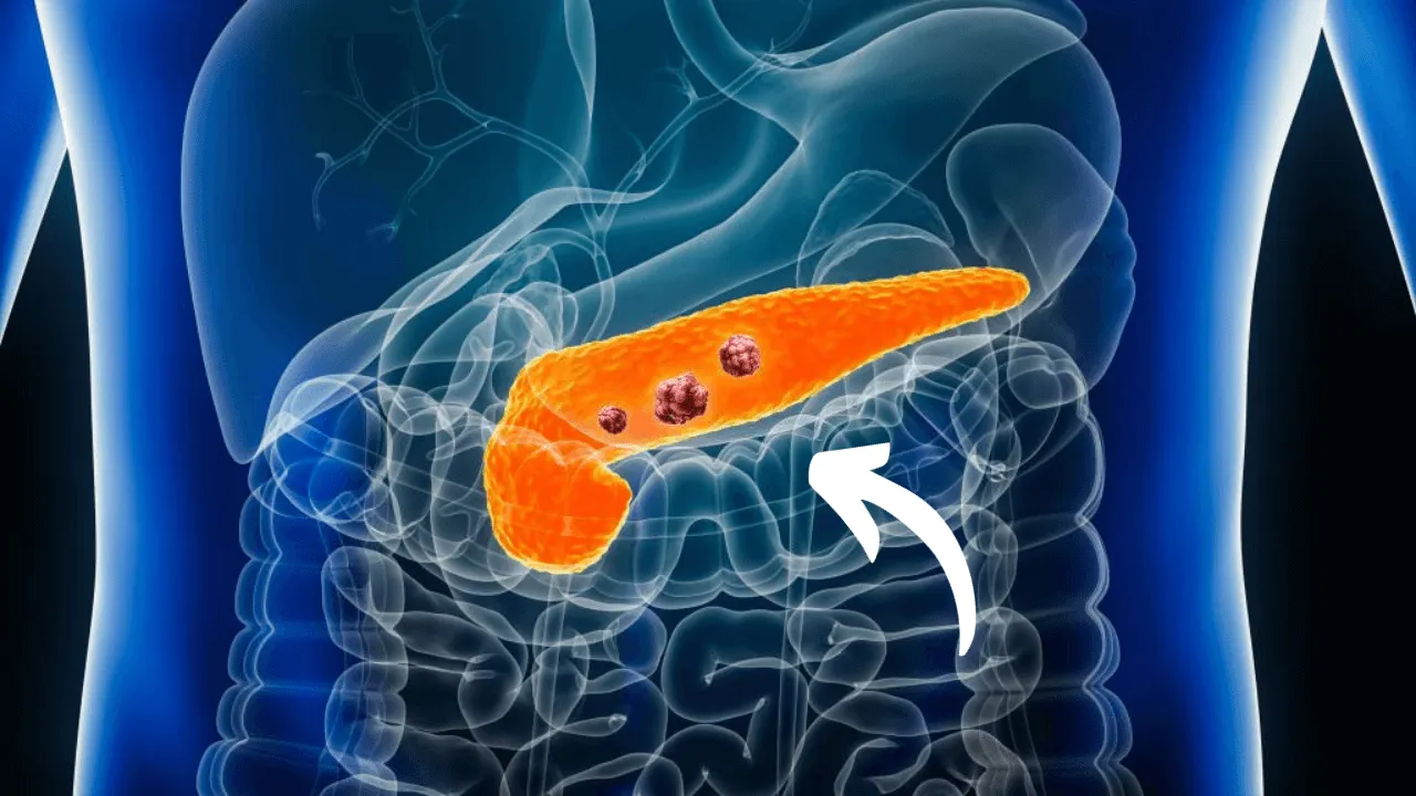 Blood sugar presentation preview